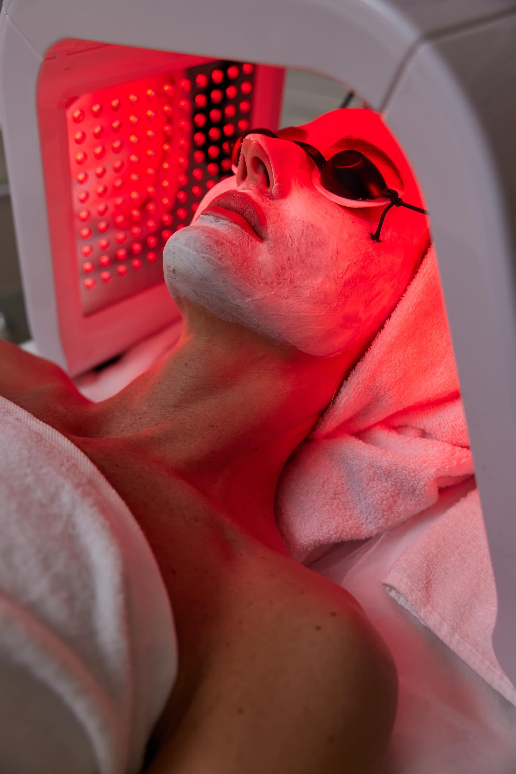 Vrouw ligt onder de LED laser lichten voor de behandeling.
